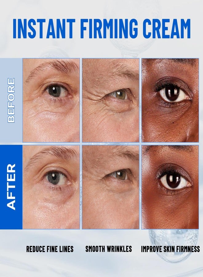 iMethod Perfection Eye Tightener - Temporary Eye Tightener Cream, Under Eye Cream Reduces Dark Circles & Puffiness, Instant Firming Formula for Fine Lines & Wrinkles, 20ml - Image 4